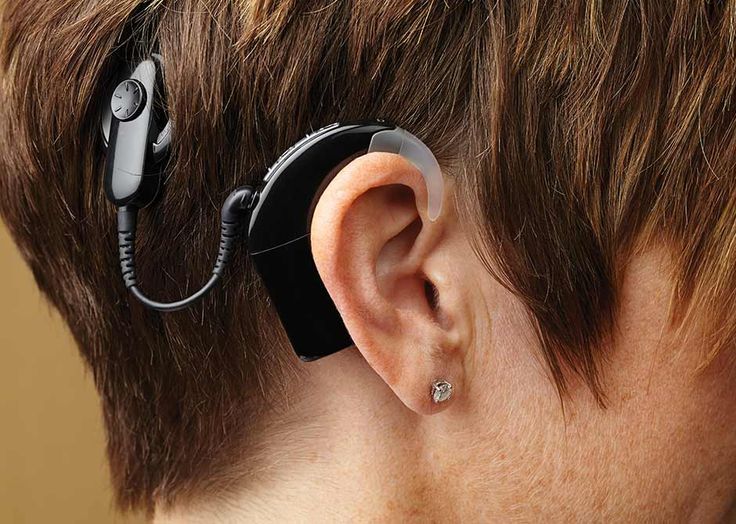 Cochlear Implant Mapping Mangalore